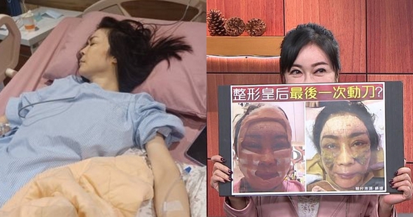 "Nữ hoàng dao kéo" chuyển từ giường bệnh ung thư sang… giường phẫu thuật thẩm mỹ, gây mê suốt 6 tiếng để căng da!