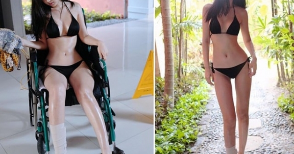 Mặc bikini khoe thân trong bệnh viện, cô gái khiến dân mạng 