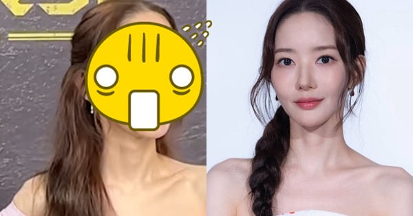 Nhan sắc giả dối của Park Min Young
