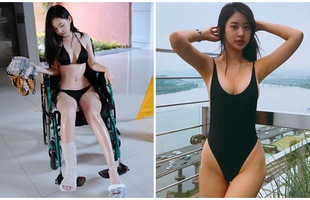 Bó bột, ngồi xe lăn nhưng vẫn mặc bikini gợi cảm, hot girl nóng bỏng khiến cả bệnh viện dậy sóng