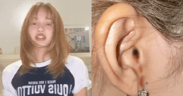 Lisa (BLACKPINK) lên tiếng về bức ảnh chảy máu tai gây hoang mang khắp MXH
