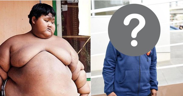 Từng nặng gần 200kg khi mới 10 tuổi, cậu bé “béo nhất thế giới” bây giờ ra sao sau hành trình giảm cân không tưởng?