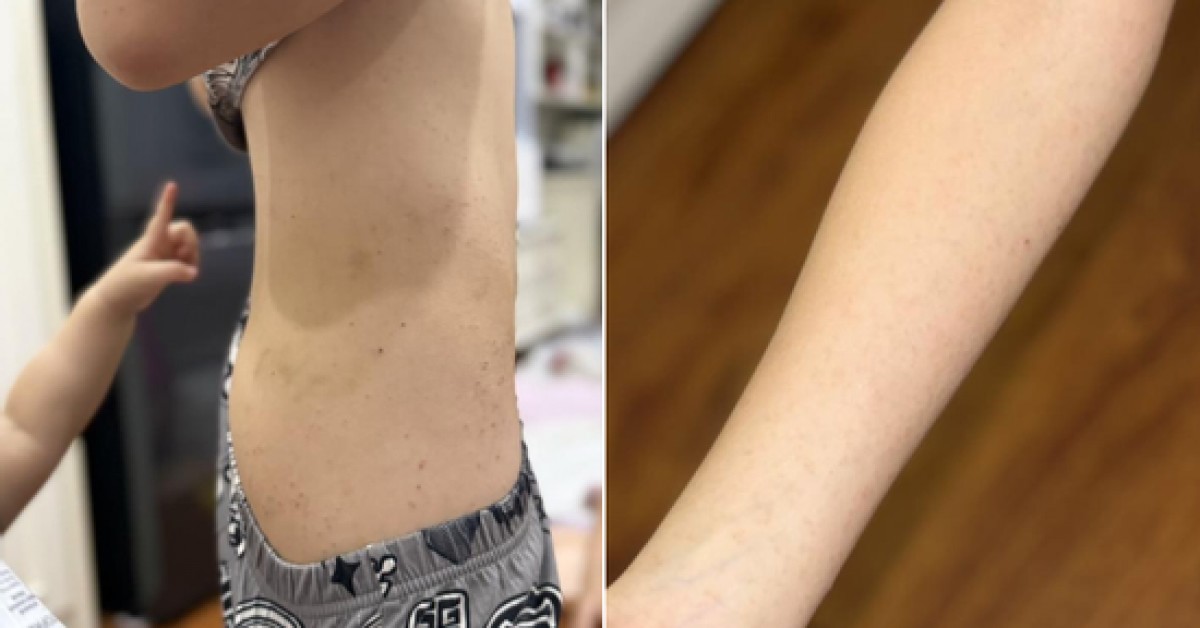 Chi gần 10 triệu đồng cho con đi trại hè 8 ngày, mẹ ở Hà Nội bức xúc khi đón con