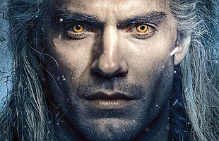 Henry Cavill bị xước mắt đến mức suýt mù vì đeo kính áp tròng quá lâu khi quay The Witcher