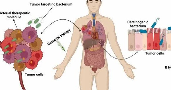 Tìm ra liệu pháp điều trị ung thư hiệu quả bằng vi khuẩn