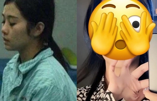 30 tỷ, 8 năm phẫu thuật, làm đám cưới với bác sĩ thẩm mỹ, số phận hot girl xinh đẹp nay ra sao?