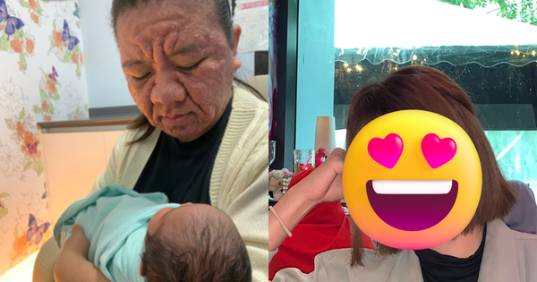 Xót xa gương mặt biến dạng sau khi mang thai của người mẹ trẻ, nhìn lại nhan sắc xinh đẹp trước đó càng không dám tin