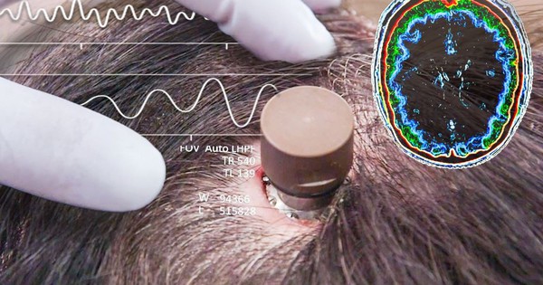 Người đàn ông bị liệt chỉnh sửa video, đăng YouTube 