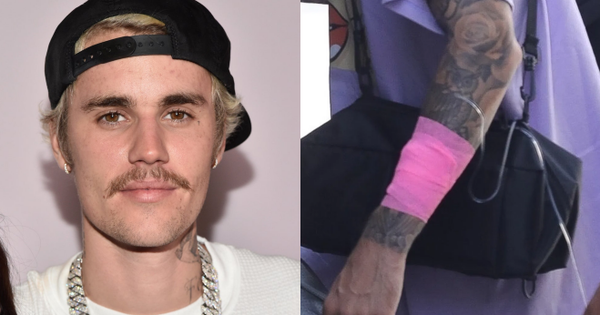 Justin Bieber hé lộ lý do xuống sắc không phanh gần đây: Mắc bệnh hiếm gặp ảnh hưởng đến não!