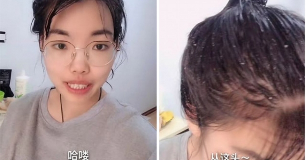 Cô gái thực hiện thử thách 100 ngày không gội đầu khiến người xem rùng mình