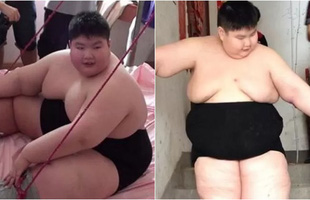 14 tuổi nặng 180kg, cậu nhóc ăn gấp 7 lần người bình thường, phụ huynh phải lên YouTube cầu viện 