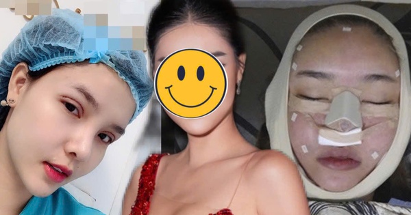 Người mẫu Việt tự khui ảnh thẩm mỹ mặt, thừa nhận rơi khủng hoảng vì sợ biến dạng vĩnh viễn