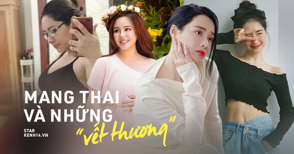 Chuyện hoa hậu Đặng Thu Thảo 