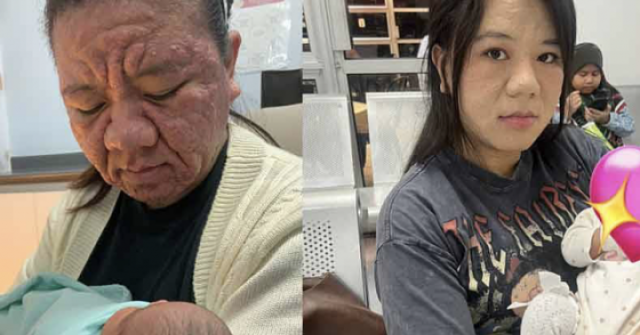 Bất ngờ nổi tiếng với khuôn mặt biến đổi khi mang bầu
