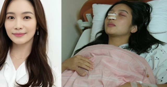 Cuộc sống mỹ nhân 'Anh em nhà bác sĩ' sau 19 năm bị chồng đánh sảy thai, gãy mũi