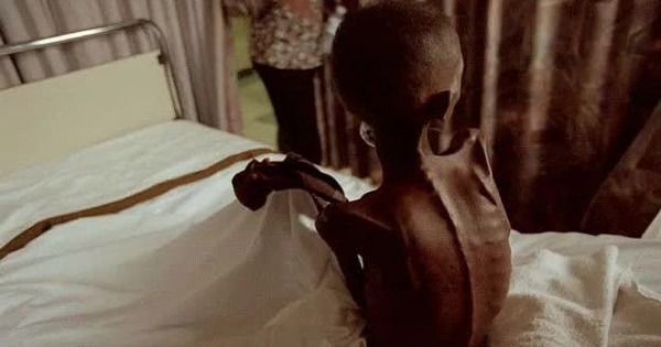 Mỗi phút, thêm một người chết vì HIV/AIDS