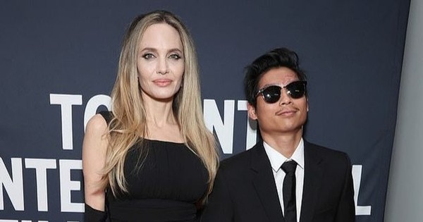 Pax Thiên đi sự kiện với Angelina Jolie, lộ sẹo lớn trên mặt