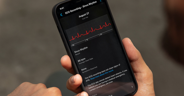 Garmin phát hành ứng dụng giúp đo điện tâm đồ trong 30 giây