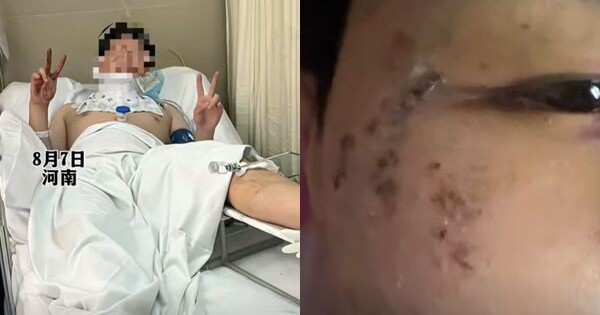 Nằm mơ mình bị rượt đuổi, thanh niên lao từ cửa sổ tầng 3 xuống đất mà không hề hay biết