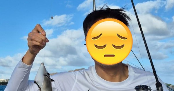 1 nam ca sĩ gây sốc khi tiết lộ não bị biến dạng nghiêm trọng