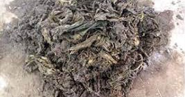 Các bác sĩ sốc nặng khi lấy ra thứ 