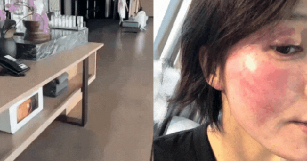 Mỹ nam lộ clip đưa gái lạ đi Phú Quốc bị vợ cũ tố cáo bạo hành đến biến dạng mặt mũi, sảy thai