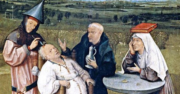 Trepanation: Thủ tục phẫu thuật sọ lâu đời nhất thế giới vẫn tồn tại đến ngày nay!