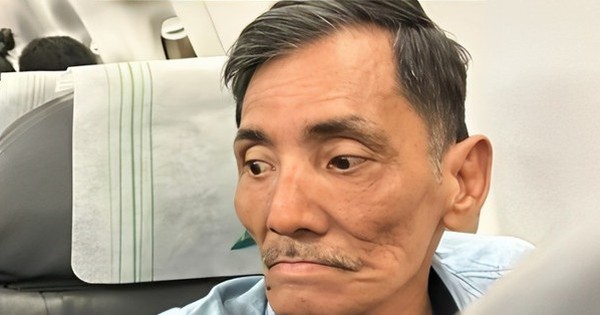 Thương Tín nguy cơ tàn tật vĩnh viễn