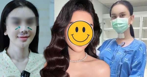 Sao nữ Vbiz bị hải quan giữ lại vì mặt lạ hoắc sau khi phẫu thuật thẩm mỹ, thừa nhận sức khỏe yếu đi rõ rệt