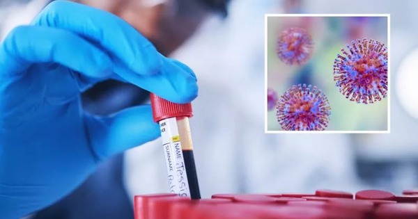 Australia thất lạc hơn 300 ống chứa virus nguy hiểm chết người