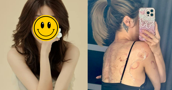 Sao nữ Vbiz đang điều trị trầm cảm: Cập nhật tình hình sức khỏe đáng chú ý