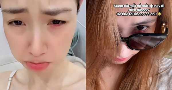 Tình trạng gây lo lắng của Hòa Minzy