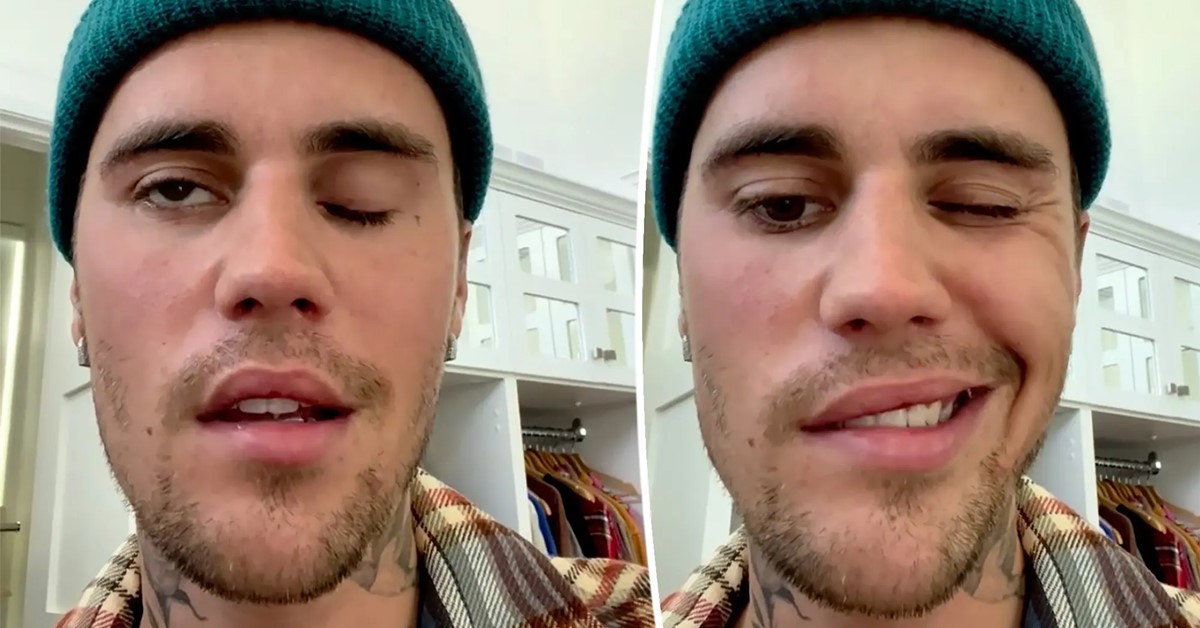 Justin Bieber bị liệt nửa mặt, liên tục hoãn show vì lý do này