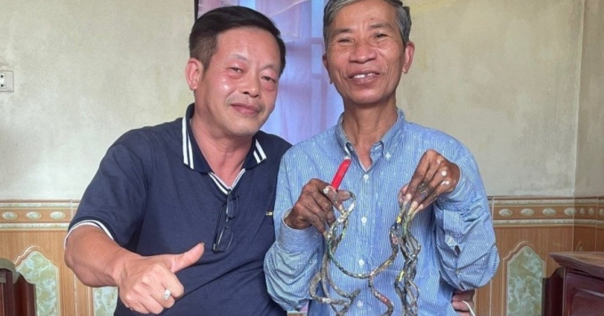 Móng tay dài hơn 1m được rao bán 7 tỷ đồng: Chủ nhân ở Nam Định nói gì?