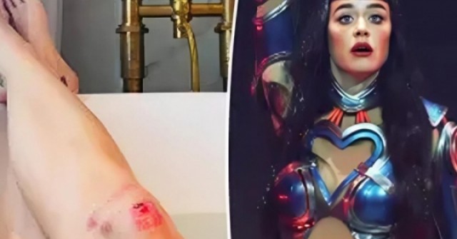 Katy Perry bị thương trong chuyến lưu diễn