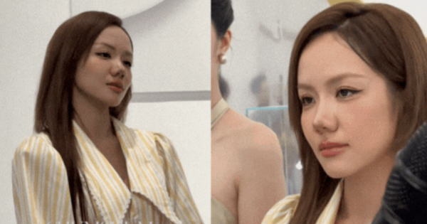 Phương Ly mới sửa mũi?
