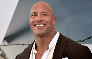 Dwayne Johnson và những sao nam phẫu thuật thẩm mỹ