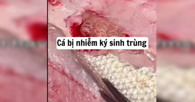 Thanh niên bất chấp ăn cá bị nhiễm sán dây chỉ để câu view