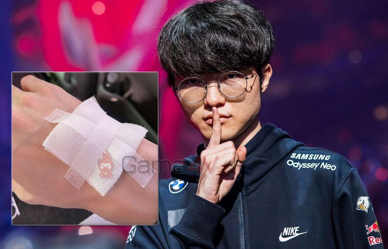 Faker bị thương ở tay, fan đùa rằng Quỷ Vương có ‘bảo hiểm 1 tỷ Won’ nên không cần lo lắng