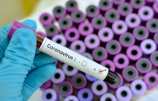 Nhóm nghiên cứu Hà Lan tìm ra kháng thể chống virus corona