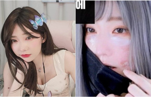 Đang là hot girl vạn người mê, nữ streamer gây sốc khi công khai gương mặt biến dị, lý do khiến ai cũng bất ngờ