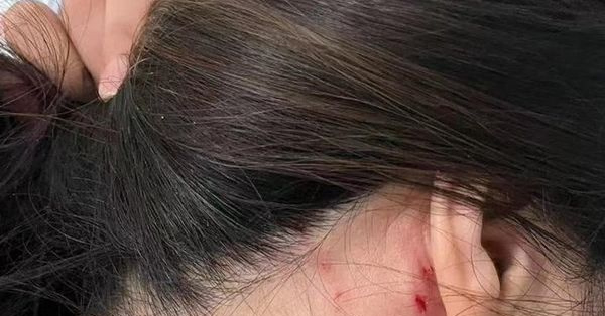 Cô gái 34 tuổi gặp chuyện đáng sợ chỉ vì từ chối đi xem mắt
