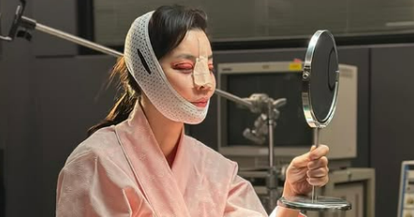 Mỹ nhân Giày Thủy Tinh gây sốc với gương mặt sưng tấy đáng sợ, băng bó kín mít