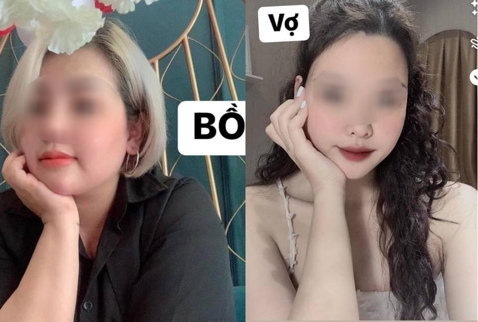 Biến căng: 