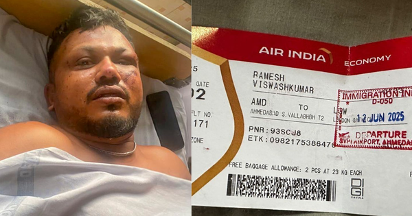 Tình hình hiện tại của người sống sót duy nhất trong thảm kịch máy bay Air India sau 3 tháng
