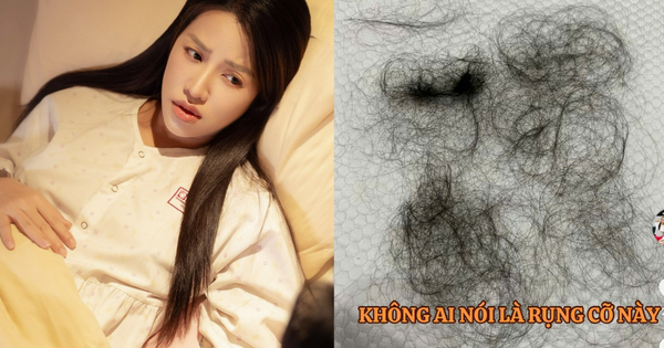 Puka gây lo lắng khi tóc rụng la liệt thành từng mảng sau khi sinh con đầu lòng