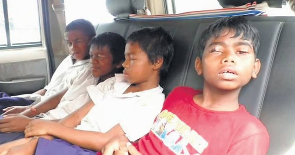 8 học sinh suýt mù vĩnh viễn vì bị bạn cùng phòng nhỏ keo dán vào mắt khi đang ngủ