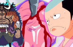 One Piece: Nếu không có người này, Luffy sẽ không bao giờ đánh bại được Kaido?