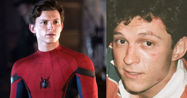 Tom Holland (Spider-Man) lộ ảnh bị đánh tơi tả và bầm dập, Marvel đang làm gì vậy?