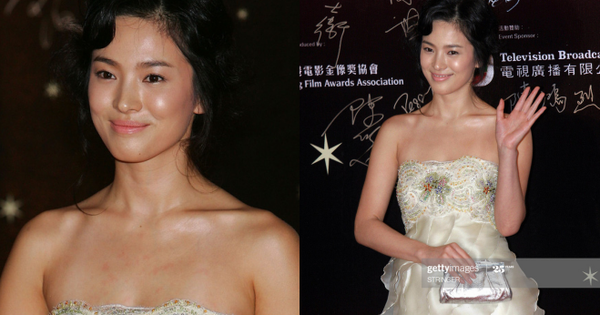 Song Hye Kyo bị 